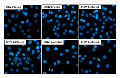 Anti-Dengue virus prM protein antibody [HL4572] used in Immunocytochemistry/ Immunofluorescence (ICC/IF). GTX644248
